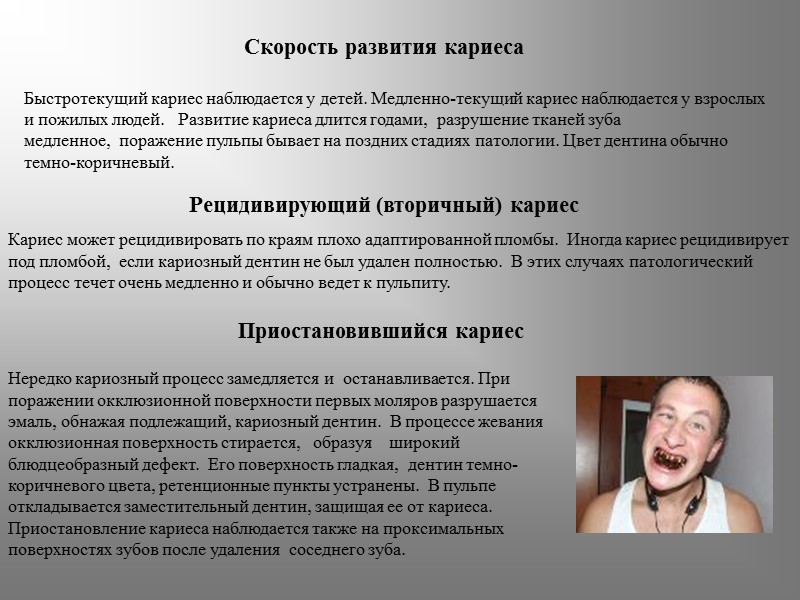 Скорость развития кариеса  Быстротекущий кариес наблюдается у детей. Медленно-текущий кариес наблюдается у взрослых